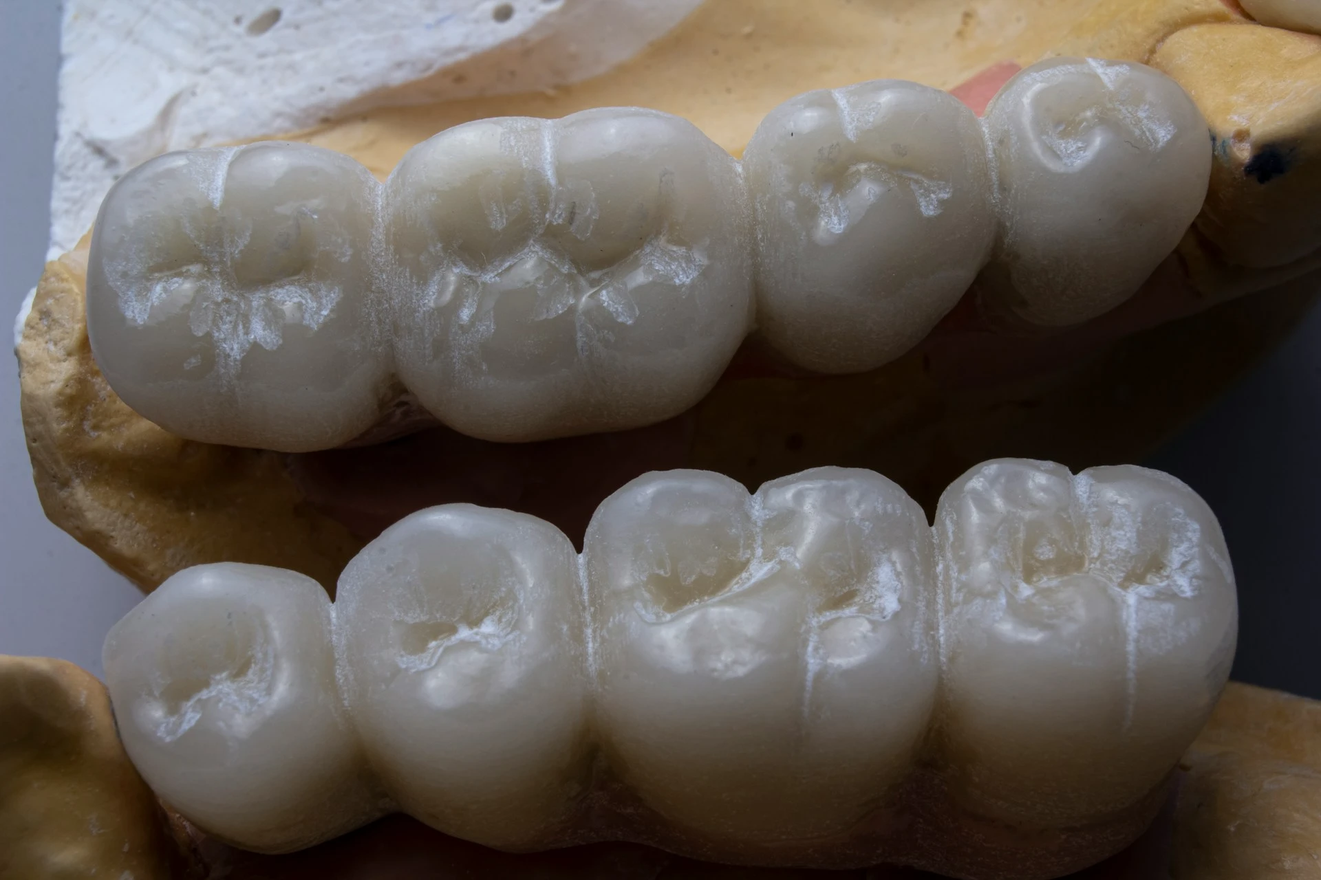 A dental cast showcasing teeth