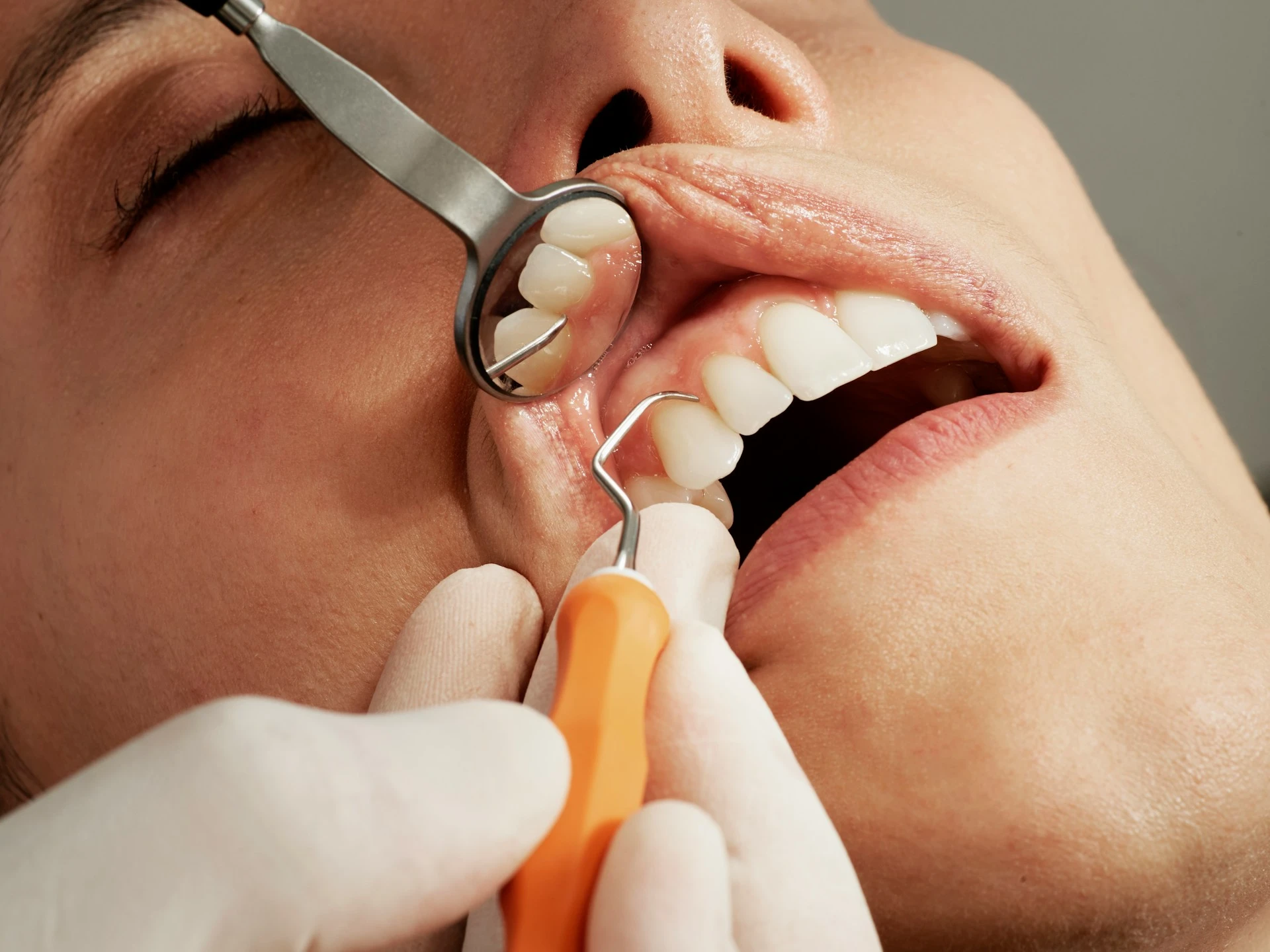 A dental check-up