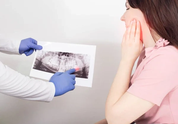 A dentist showing a panoramic X-ray to a female patient with jaw pain, pointing out an impacted wisdom tooth