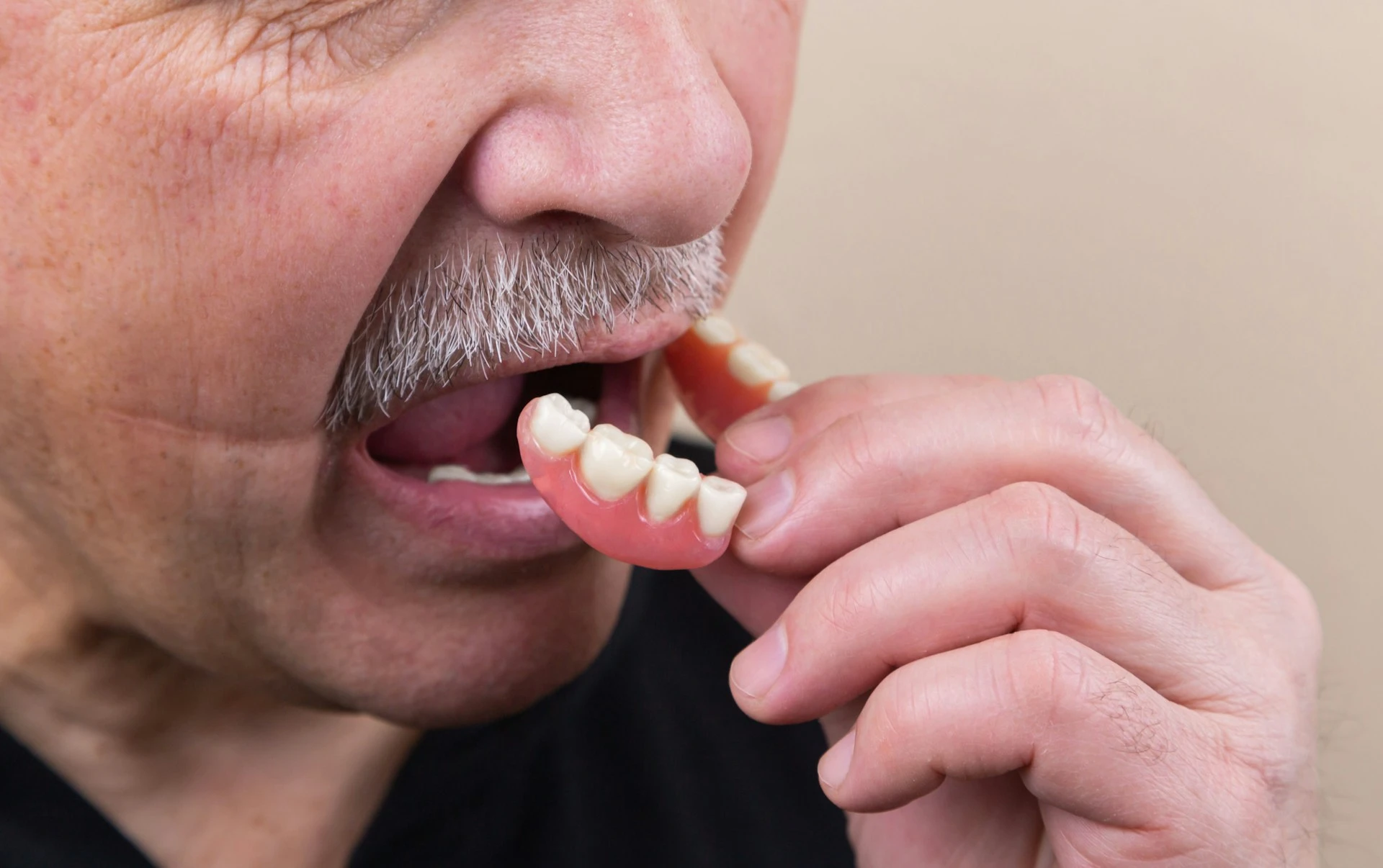 A man putting on his removable denture