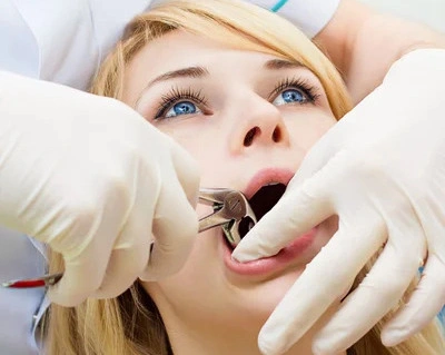 Close-up of a dentist using extraction forceps to remove a damaged tooth during an oral surgery procedure