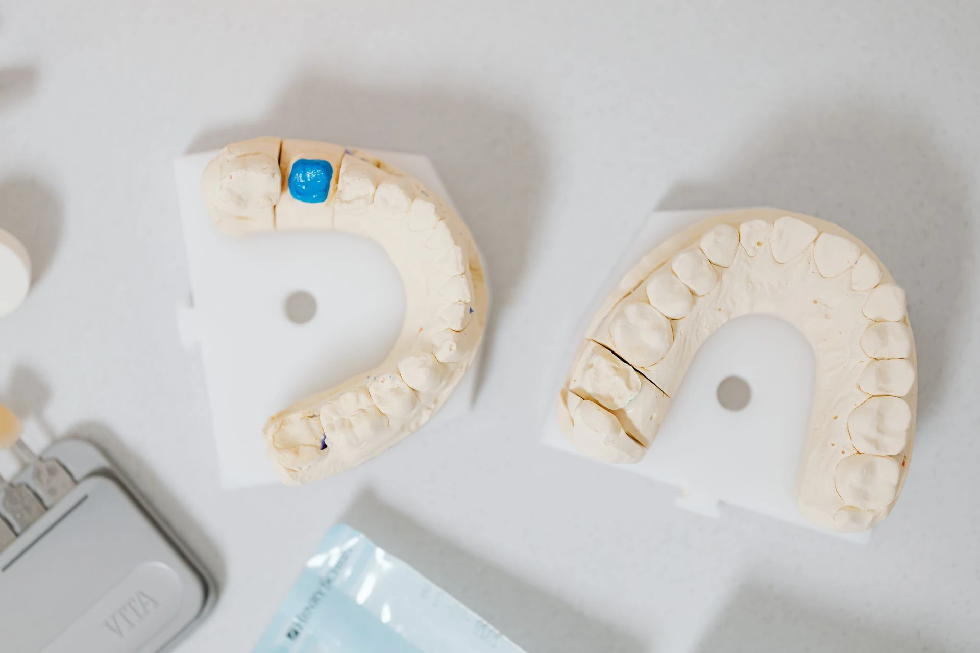 Close-up of dental molds on a white table, showcasing orthodontic details