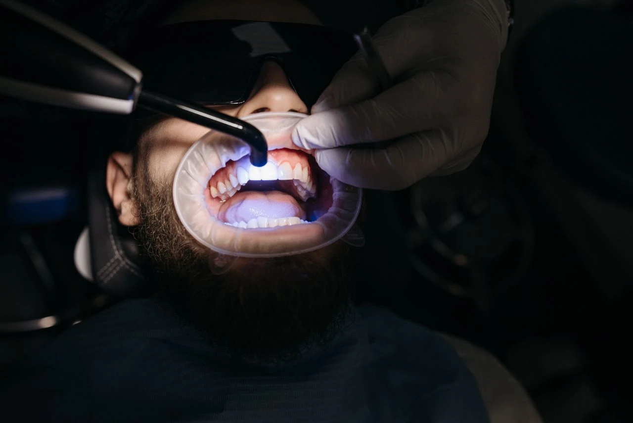 Close-up of dentist using ultraviolet light on a patient's teeth