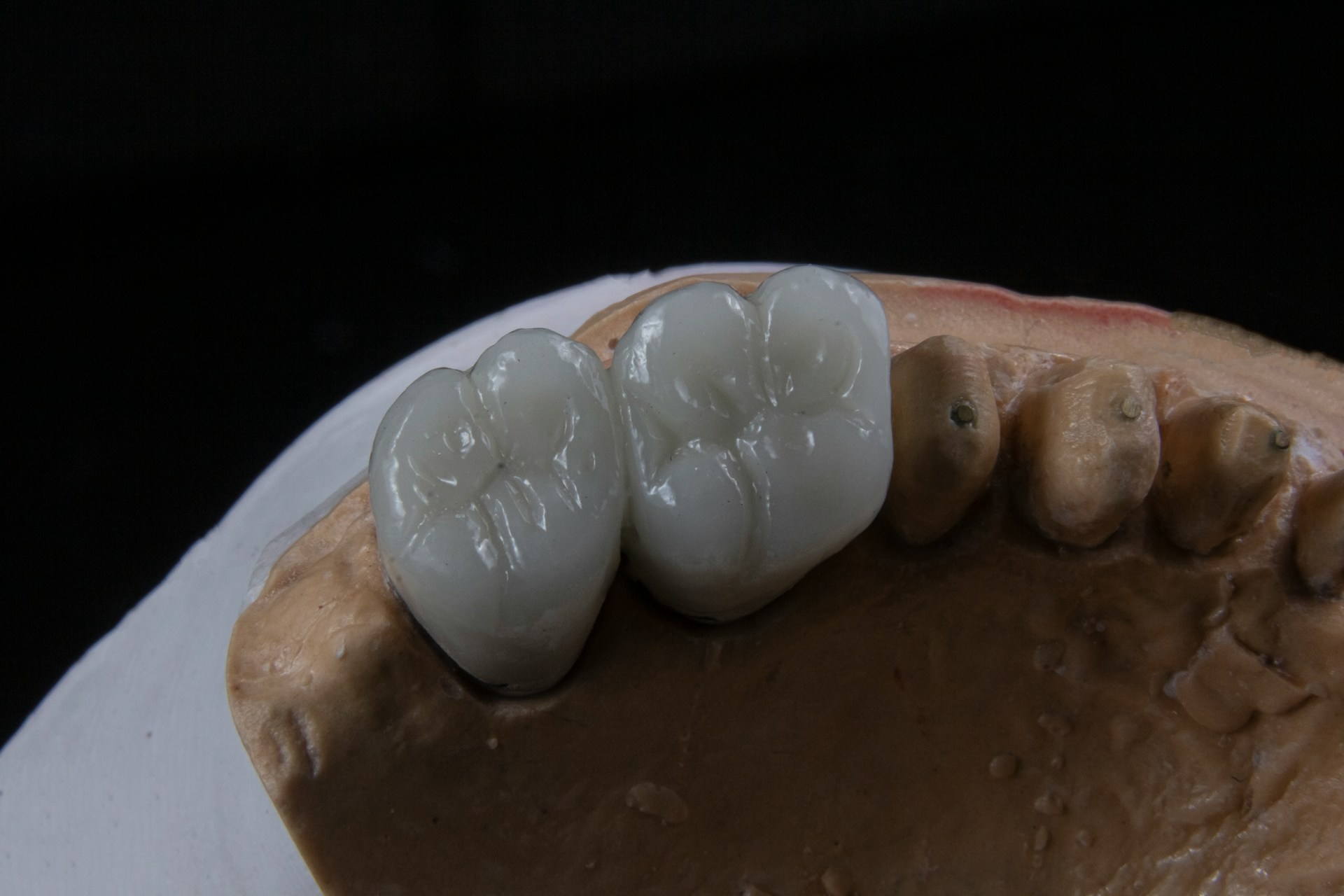 A dental cast with two newly crafted teeth on it