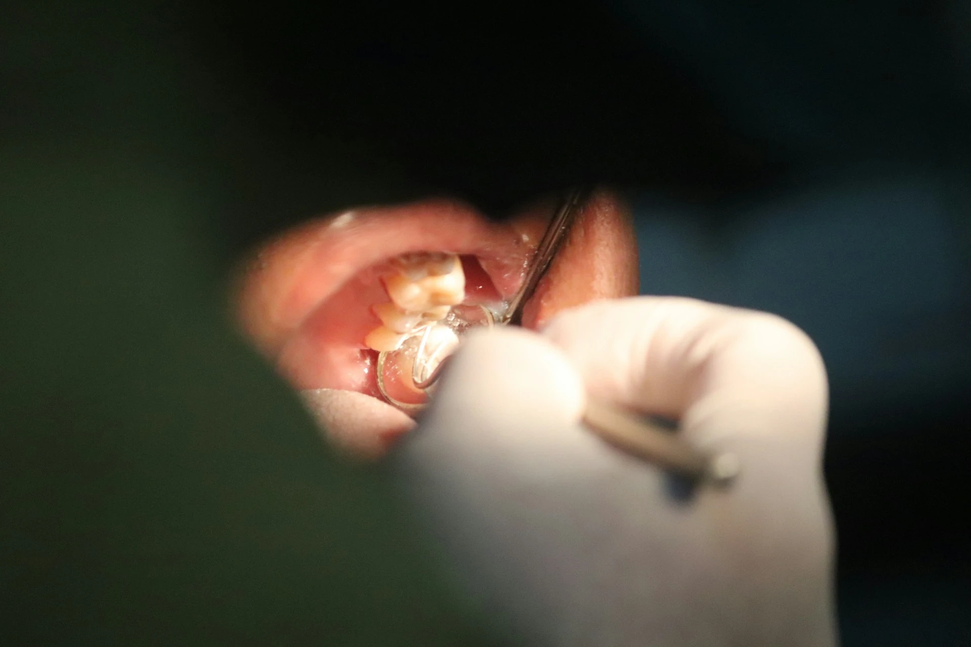 Dentist examining teeth