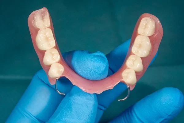 Dentist holding partial denture