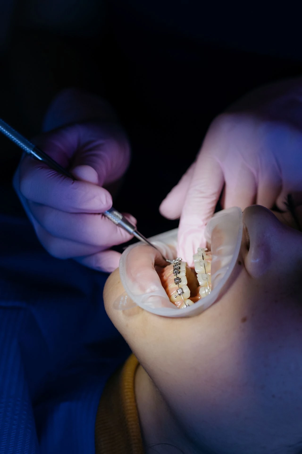 Dentist performing a check-up adjustment on a patient with orthodontic braces.