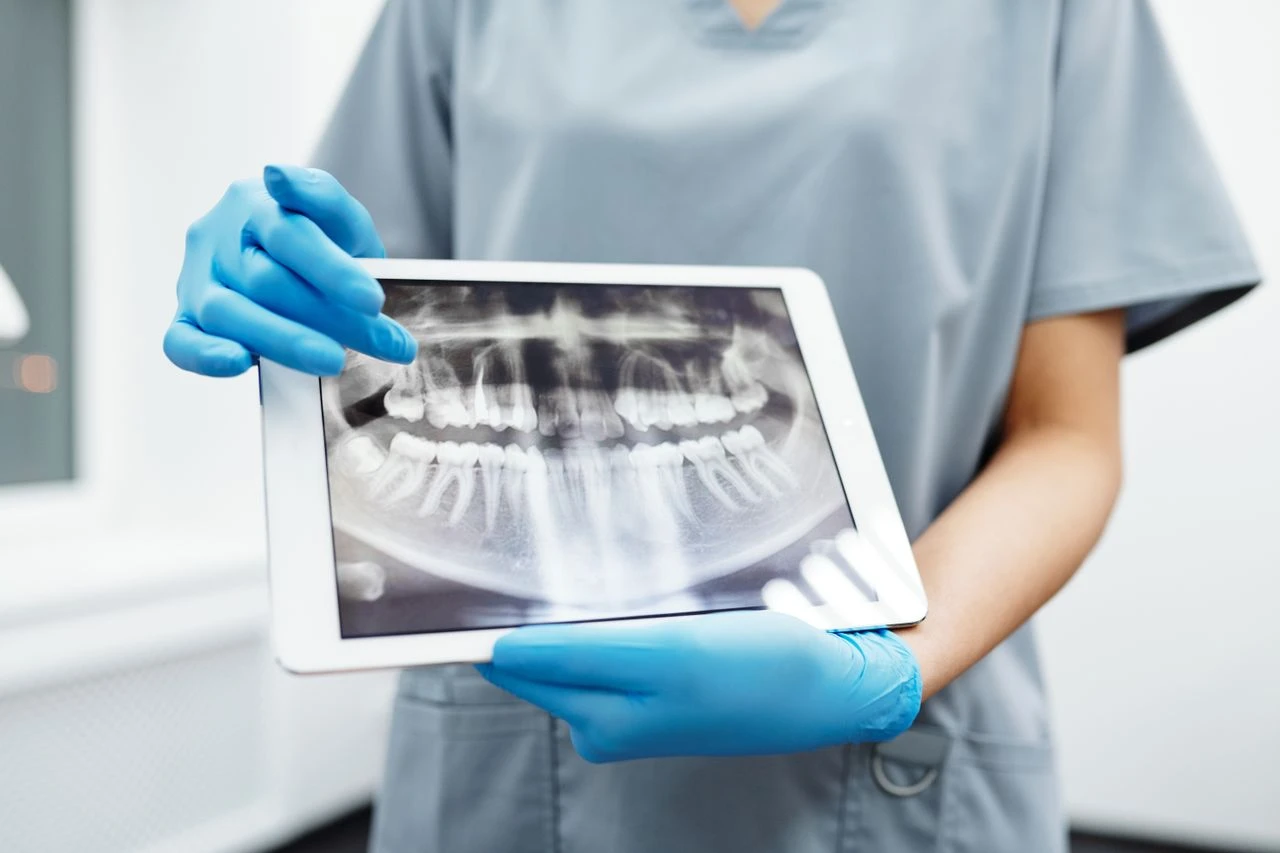 Digital Dental X-Ray Examination
