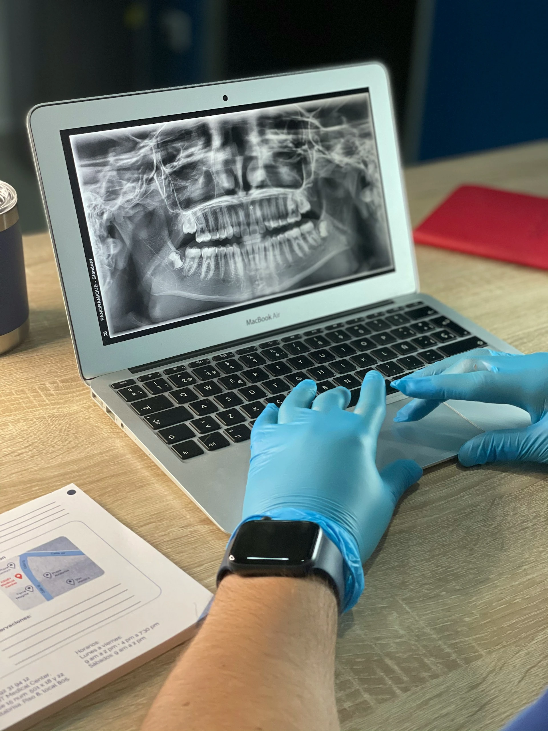 Digital X-Ray - Dental Examination