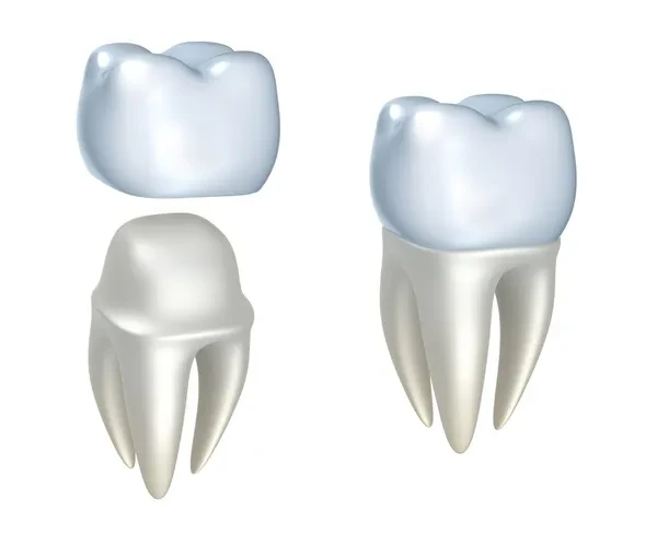 Graphics of a dental crown and tooth