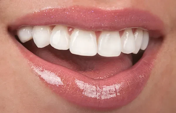 Healthy teeth, beautiful smile