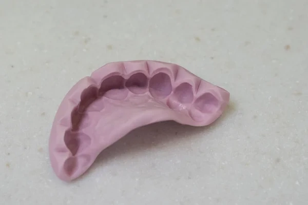High-precision dental impression mold on a clinic countertop.
