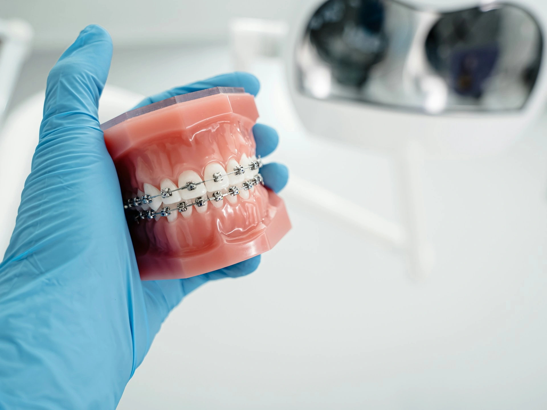A gloved hand holding a dental jaw model fitted with self-ligating braces