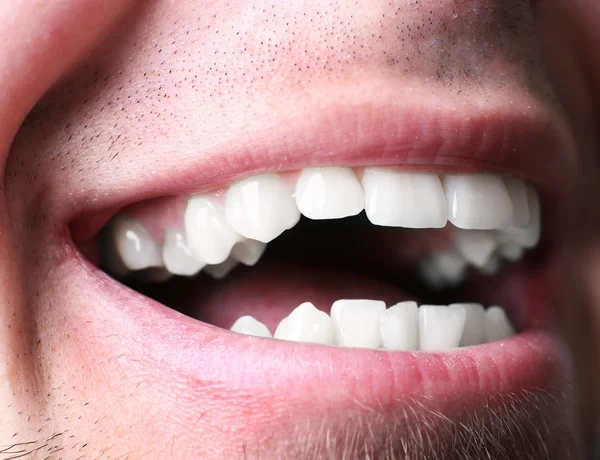 Close-up of a man smiling with bright, healthy white teeth after a dental cosmetic procedure